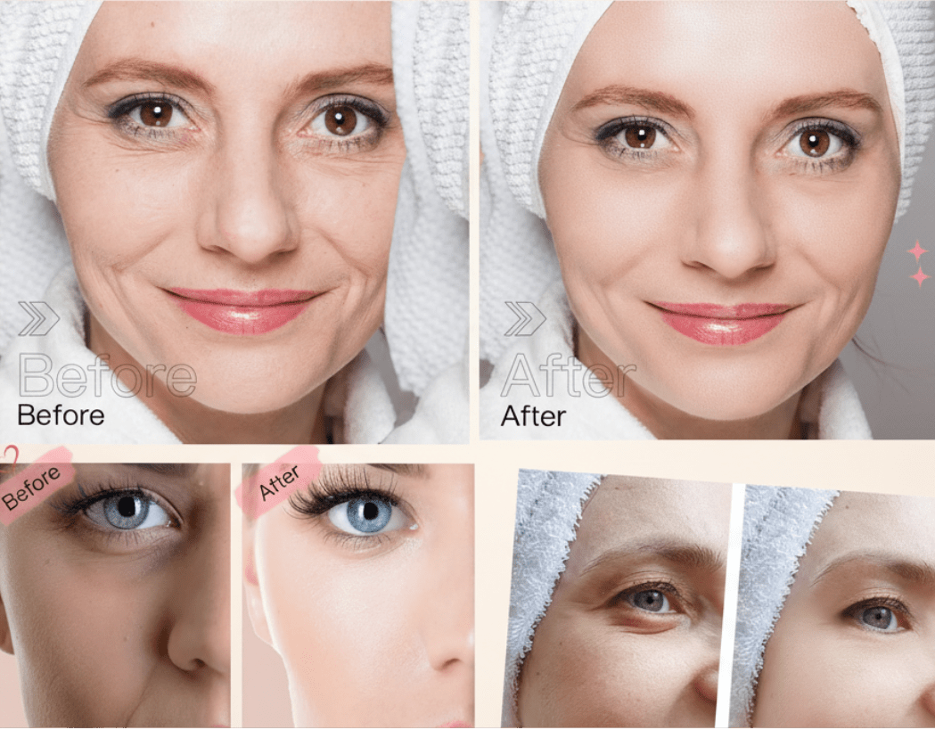 Before and after comparison of facial treatments with visible results in just one month.