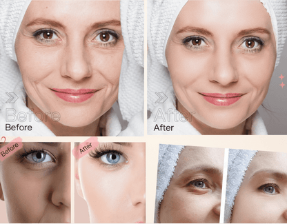 Before and after comparison of facial treatments with visible results in just one month.