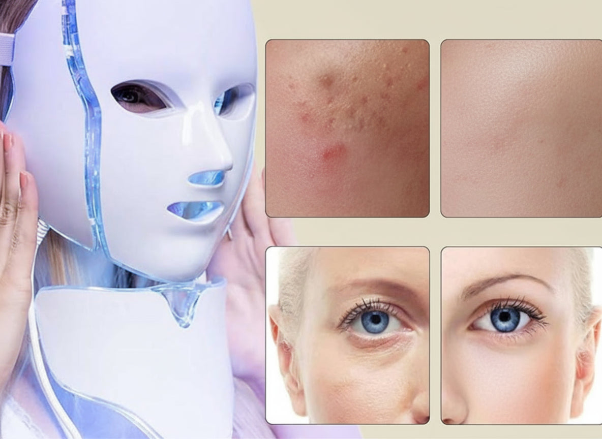 Facial mask device with before and after skin comparison on a beige background