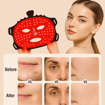 Woman using a face mask light therapy device with 'Before' and 'After' results shown.