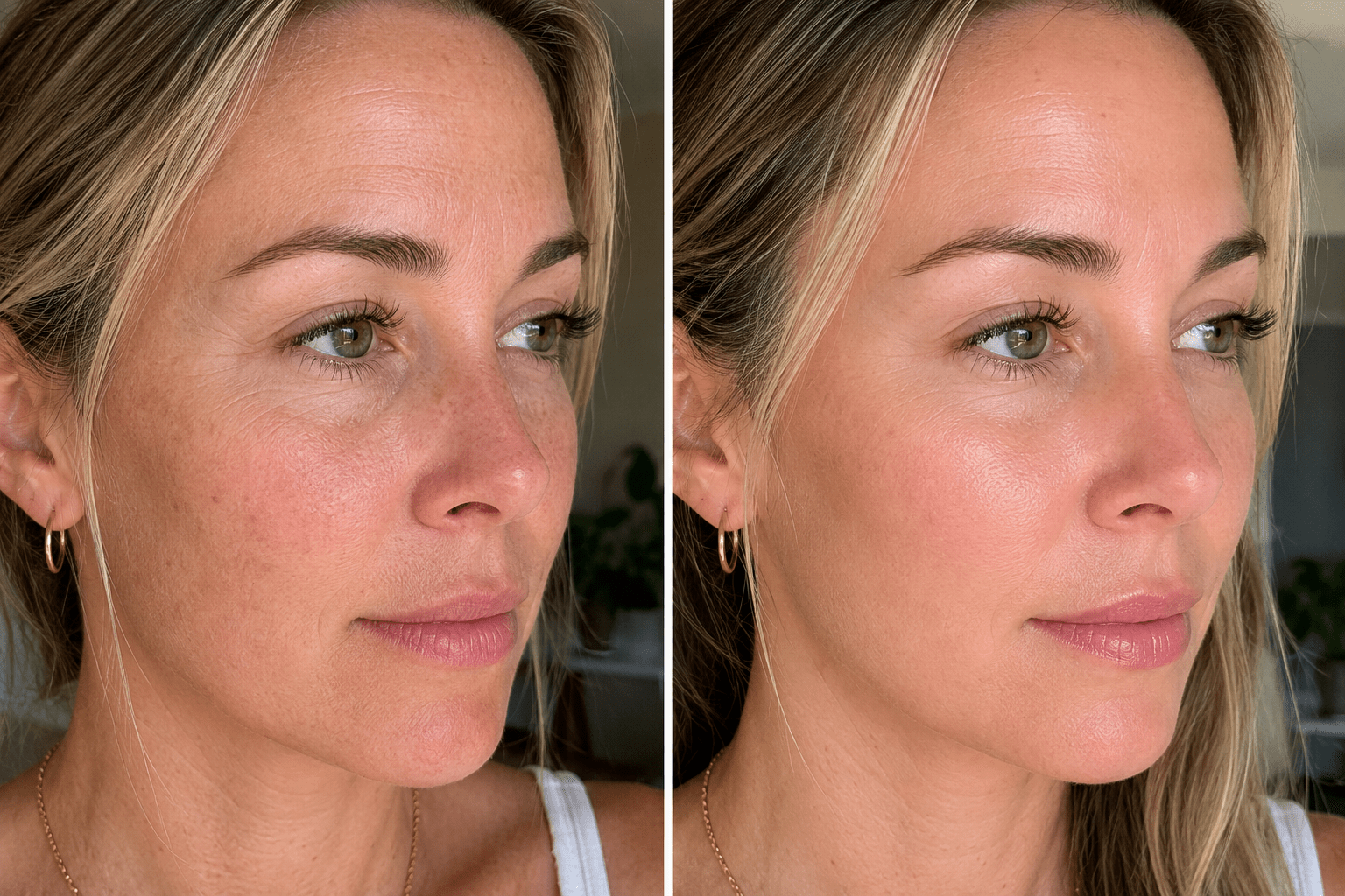 Side-by-side comparison of a woman's face 